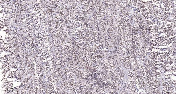 a30468 srsf3 primary antibodies ihc testing 2