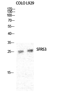 a30468 srsf3 primary antibodies wb testing 5