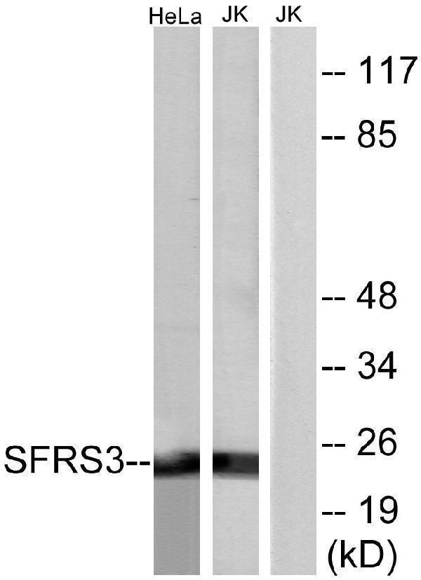 a30468 srsf3 primary antibodies wb testing 6