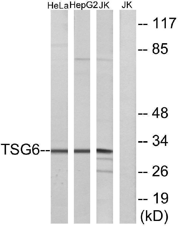 a30469 tnfaip6 primary antibodies wb testing 2