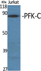 Western Blot analysis of various cells using PFK-C Polyclonal Antibody