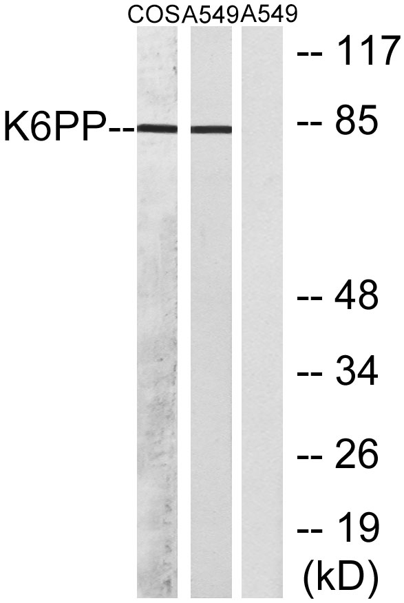 a30471 pfkp primary antibodies wb testing 4