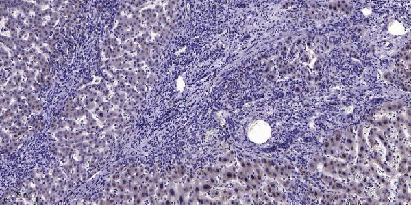 a30472 nhlh1 primary antibodies ihc testing 1