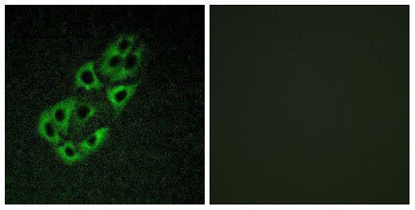 Immunofluorescence analysis of A549 cells, using MtSSB Antibody
