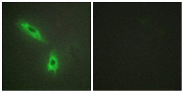 Immunofluorescence analysis of HeLa cells, using TNFC Antibody