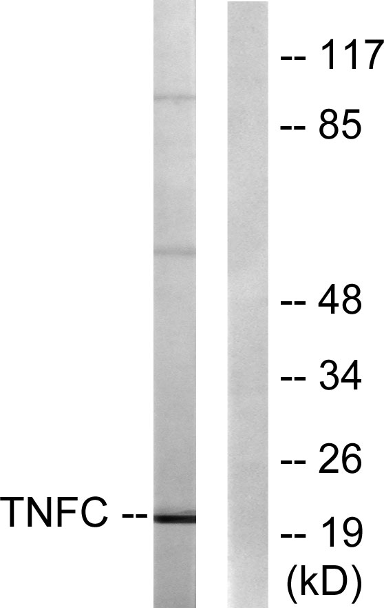 Western blot analysis of lysates from HepG2 cells, using TNFC Antibody