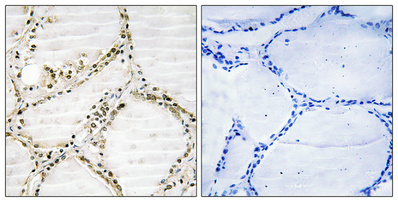 a30477 srsf4 primary antibodies ihc testing 1