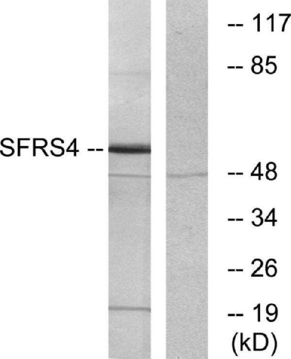 a30477 srsf4 primary antibodies wb testing 3