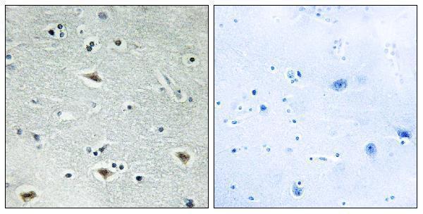 Immunohistochemistry analysis of paraffin-embedded human brain tissue, using MTG16 Antibody