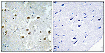 Immunohistochemical analysis of paraffin-embedded Human brain