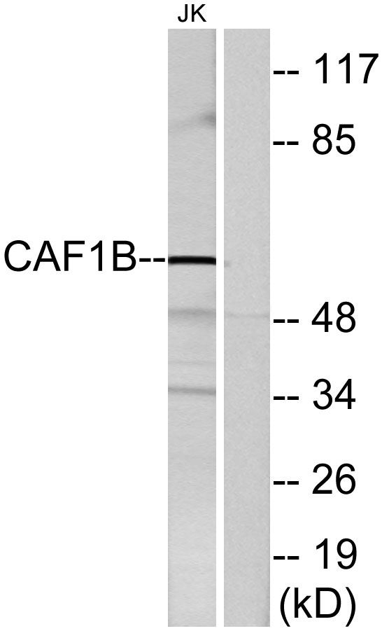 Western blot analysis of lysates from Jurkat cells, using CAF1B Antibody