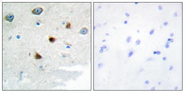 a30480 dusp4 primary antibodies ihc testing 1