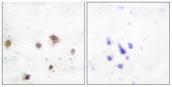 Immunohistochemistry analysis of paraffin-embedded human brain tissue, using JIP2 Antibody