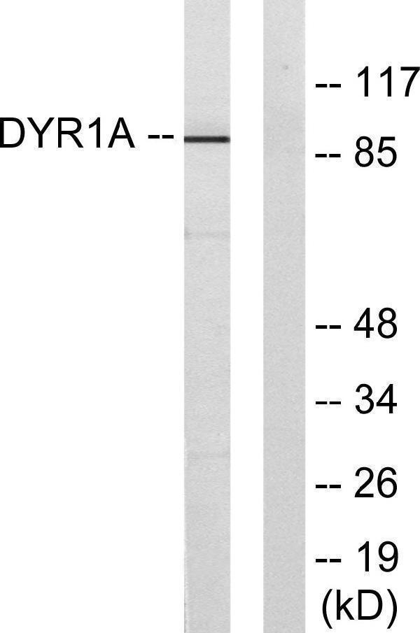 a30487 dyrk1a primary antibodies wb testing 5