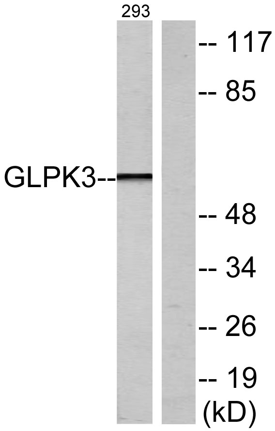 Western blot analysis of lysates from 293 cells, using GK3 Antibody