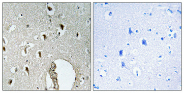 a30494 hlx primary antibodies ihc testing 2
