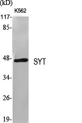 Western Blot analysis of various cells using SYT Polyclonal Antibody