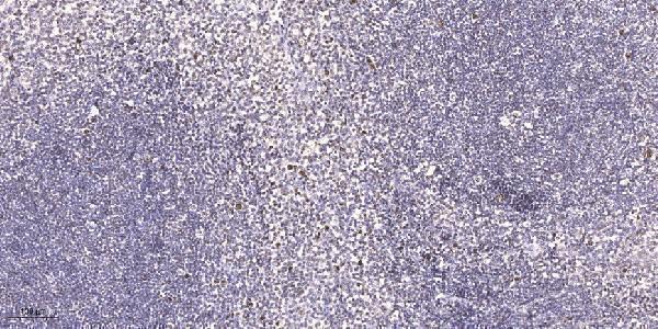 Immunohistochemical analysis of paraffin-embedded human tonsil