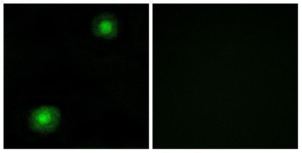 Immunofluorescence analysis of A549 cells, using ZNF187 Antibody
