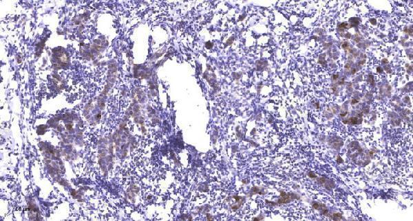 a30501 pfkfb1 primary antibodies ihc testing 1