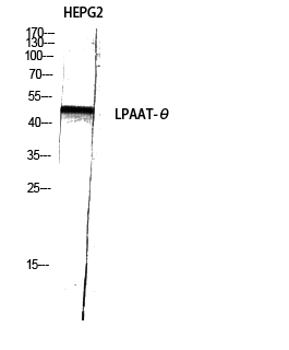 Western Blot analysis of HEPG2 using LPAAT-θ Polyclonal Antibody diluted at 1:1000