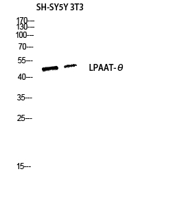 Western blot analysis of SH-SY5Y 3T3 lysis using LPAAT-θ antibody