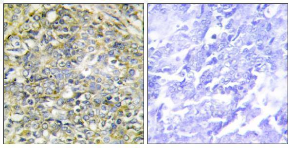 a30506 ubxn11 primary antibodies ihc testing 1
