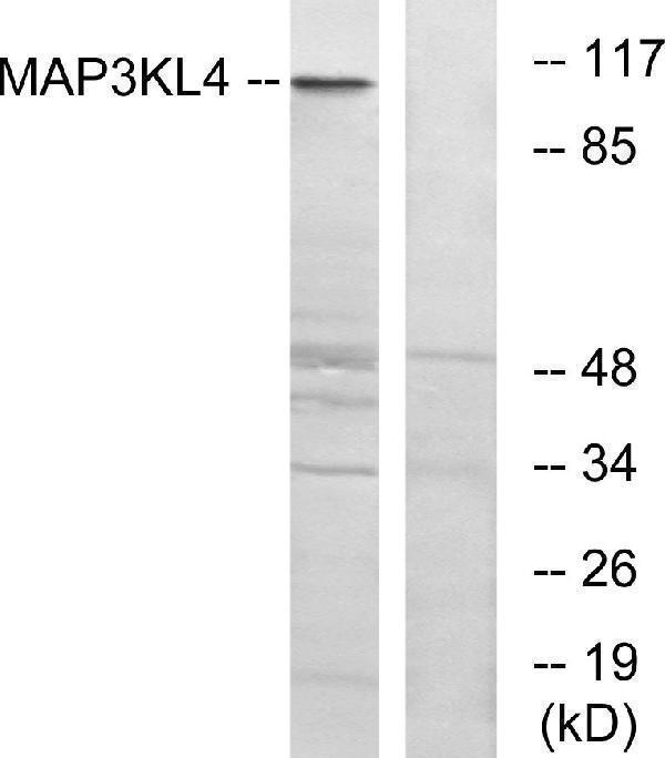 a30507 map3k21 primary antibodies wb testing 3