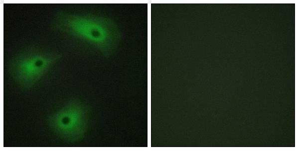 Immunofluorescence analysis of HeLa cells, using TM16A Antibody