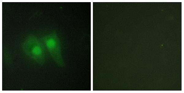 Immunofluorescence analysis of HeLa cells, using STEA3 Antibody