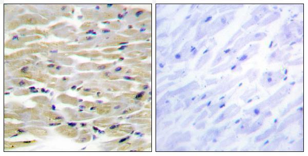 Immunohistochemistry analysis of paraffin-embedded human heart tissue, using TENS3 Antibody