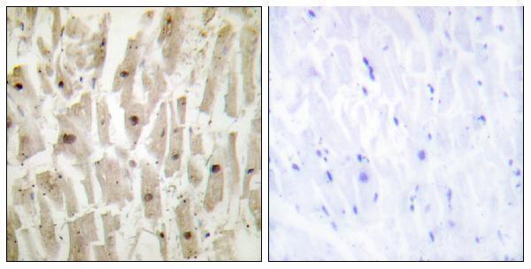 a30513 tshz1 primary antibodies ihc testing 1
