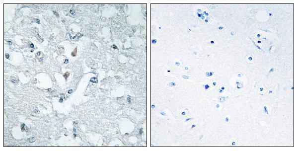 a30520 glyctk primary antibodies ihc testing 2