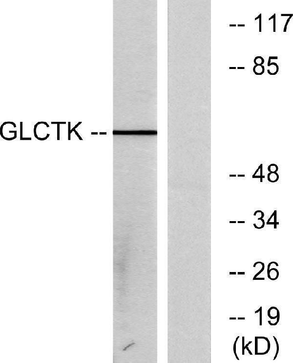 a30520 glyctk primary antibodies wb testing 3