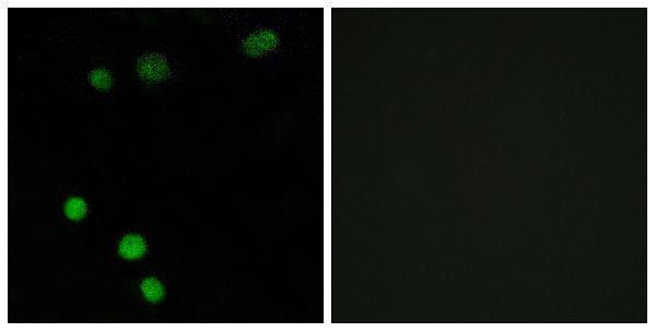 Immunofluorescence analysis of MCF7 cells, using TP53INP2 Antibody