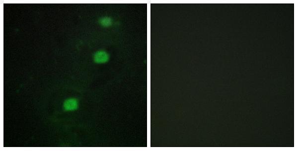 a30522 cdk20 primary antibodies if testing 1