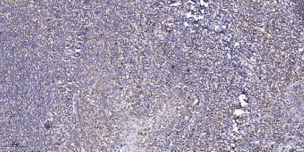 a30522 cdk20 primary antibodies ihc testing 2