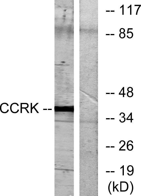a30522 cdk20 primary antibodies wb testing 3