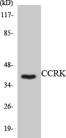 a30522 cdk20 primary antibodies wb testing 4