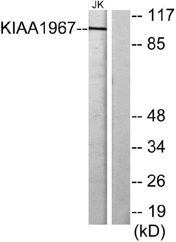 Western blot analysis of lysates from Jurkat cells, using KIAA1967 Antibody