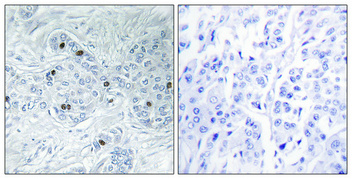 a30524 mink1 primary antibodies ihc testing 1