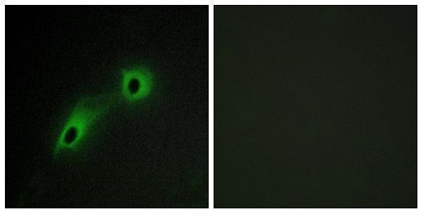 a30525 camkv primary antibodies if testing 1