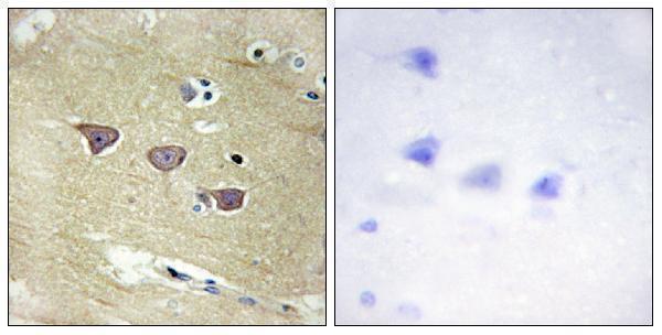 a30525 camkv primary antibodies ihc testing 2