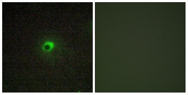 a30526 acvr1c primary antibodies if testing 1