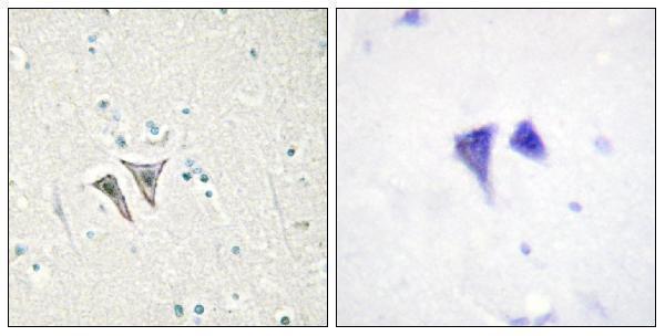 a30526 acvr1c primary antibodies ihc testing 2