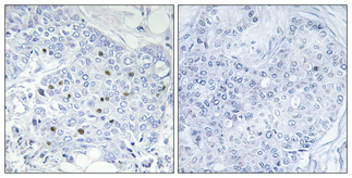 a30528 arid1b primary antibodies ihc testing 2