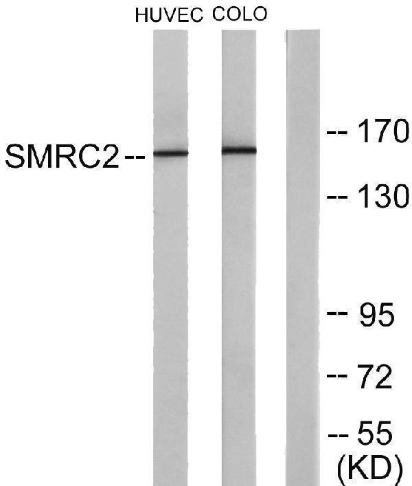 Western blot analysis of lysates from HUVEC and COLO205 cells, using SMRC2 Antibody
