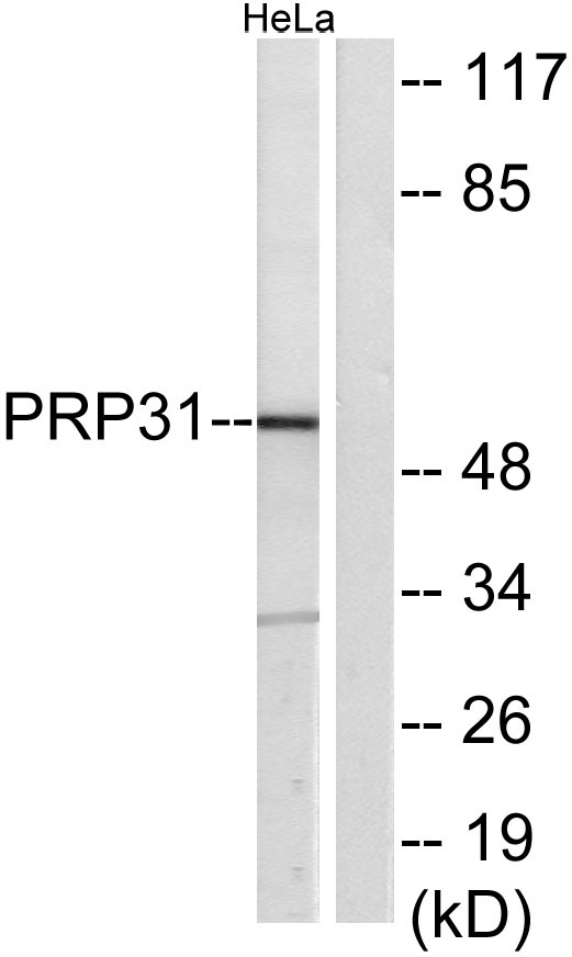 Western blot analysis of lysates from HeLa cells, using PRP31 Antibody
