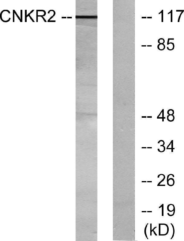 Western blot analysis of lysates from Jurkat cells, using CNKR2 Antibody