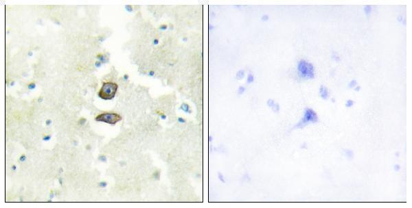 a30536 bri3bp primary antibodies ihc testing 1